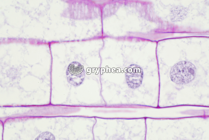 Mitose dans une racine de Blé (fin de télophase) x200 - gryphea.com